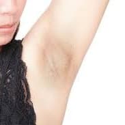 Model Armpits Lightening Package at Embrace Beauty Ink in Libertyville, IL
